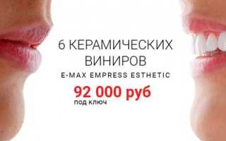 Фарфоровые зубы: коронки из фарфора
