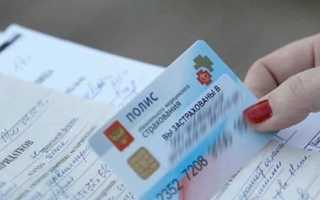 Детские брекеты по омс