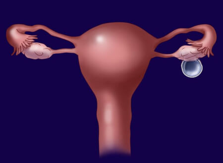 Выделения при наличии кист в яичниках