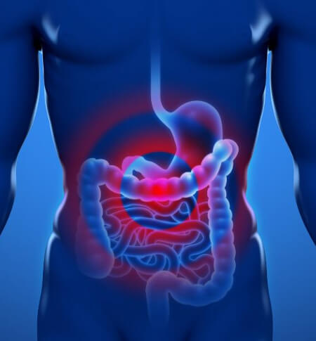 Патологии желудочно-кишечного тракта при невсасывание противозачаточных