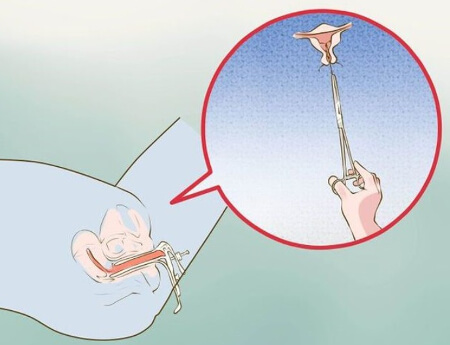 Алгоритм извлечения ВМС