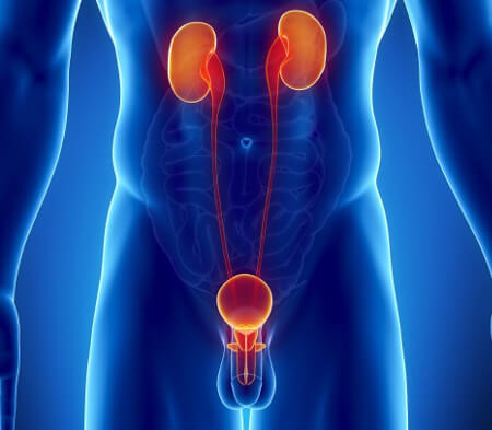 Урологический презерватив при инфекции мочевых путей