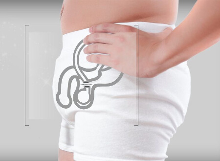 Длительность процедуры вазэктомии