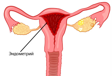 Полноценный эндометрий