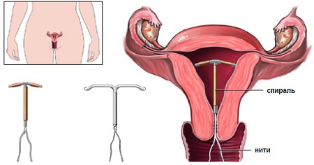 Установка вмс