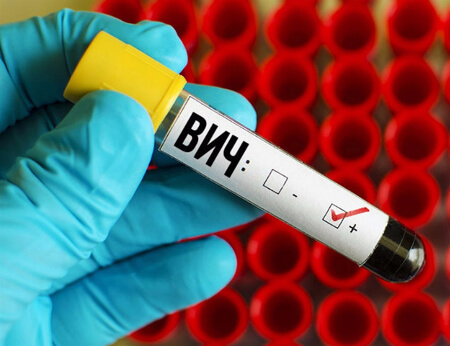 Внутриматочная спираль при наличии ВИЧ-инфекции
