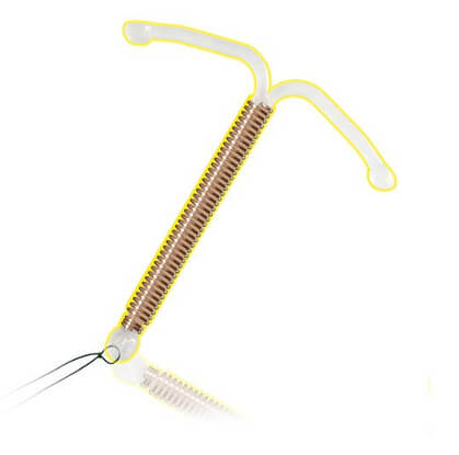 Внутриматочная спираль Юнона Био Т супер