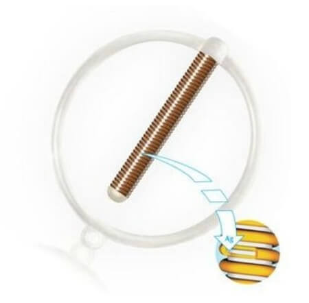 Внутриматочная кольцеобразная спираль Юнона