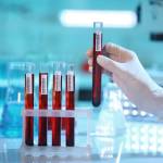 Анализ крови перед выбором вмс