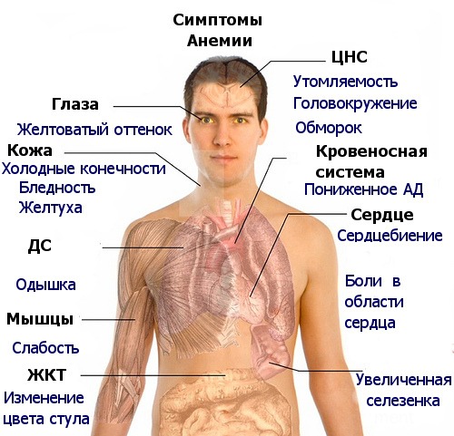 Железодефицитная анемия